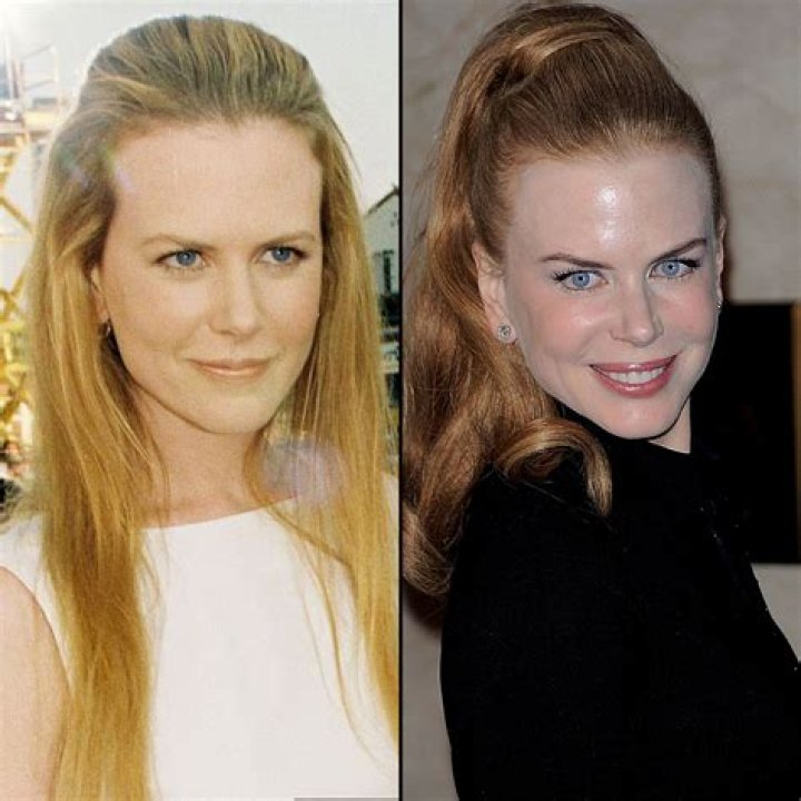 Nicole Kidman Nicole Kidman